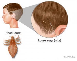   Head lice infect the scalp and hair and can be seen at the nape of the neck and over the ears. Head lice spread easily and quickly but do not carry disease as other lice do.